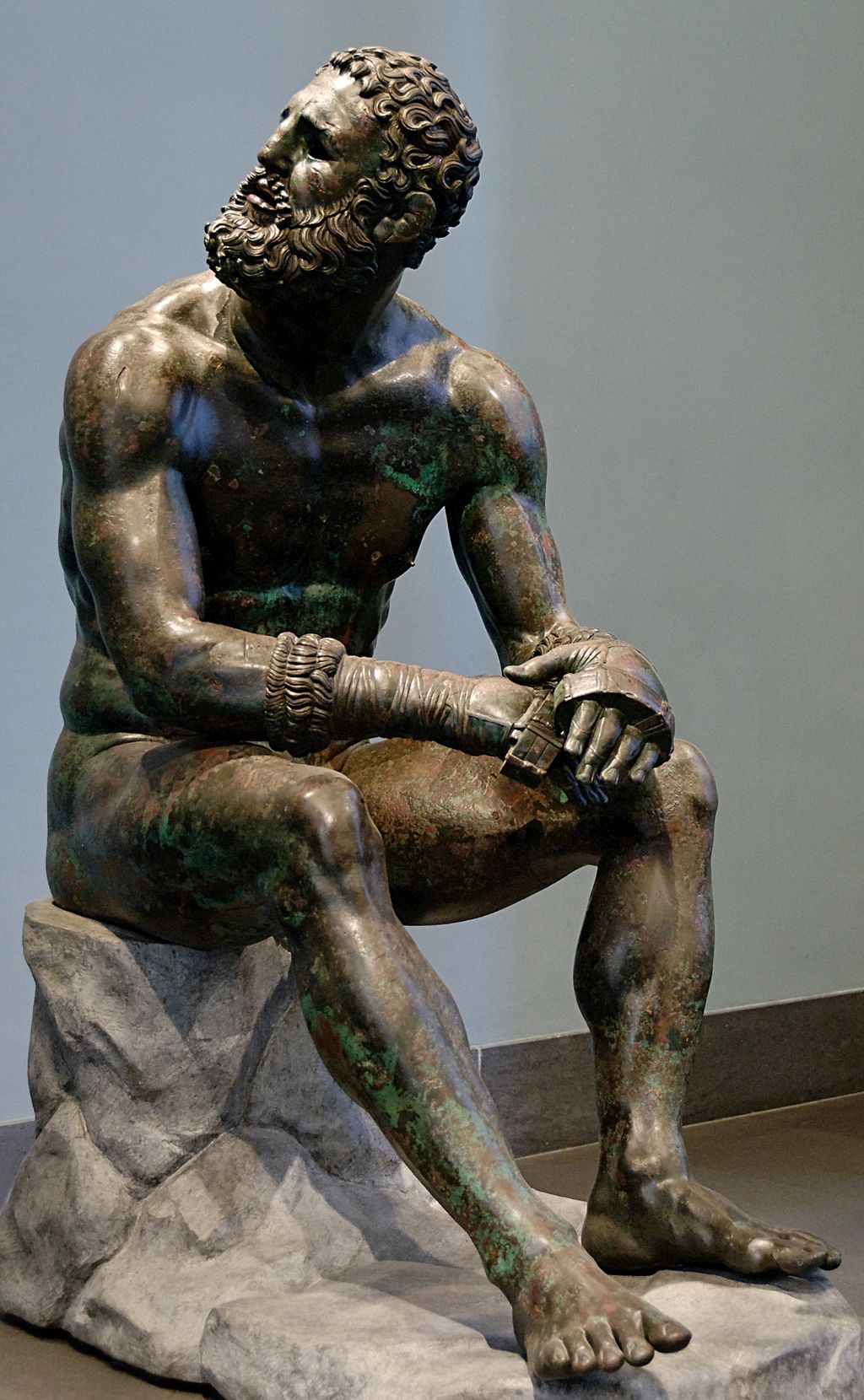 Resting boxer, 2nd-3d century BC (Palazzo Massimo)<br>Source: Wikipedia